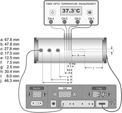 Electrosurgery and Temperature Increase in Tissue With a Passive Metal Implant